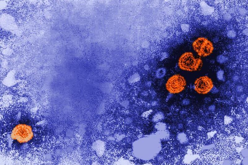 Hepatitis-B-Viren (Quelle: Escin Palmer / CDC)