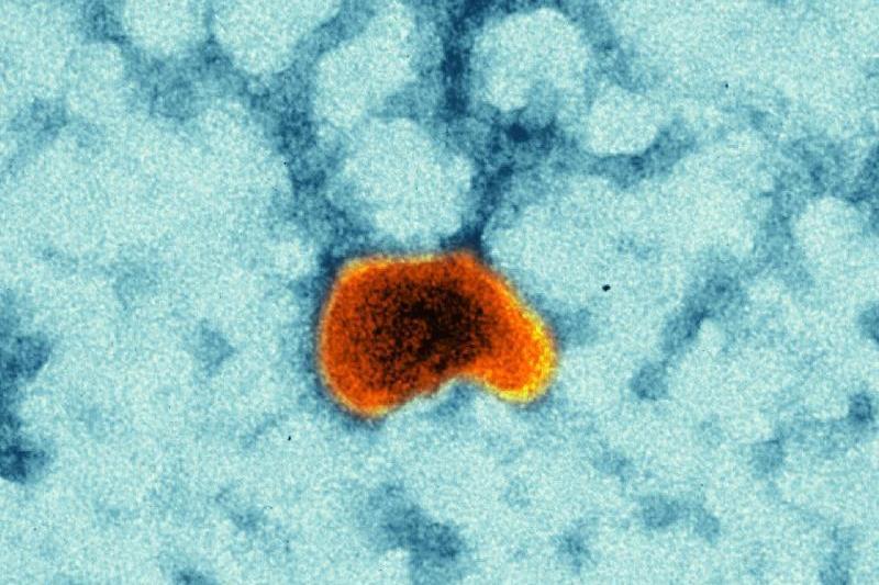 Masern-Impfvirus (Quelle: K. Boller / Paul-Ehrlich-Institut)