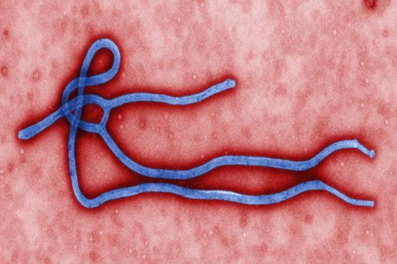 Ebola-Virus (Quelle: Cynthia Goldsmith / CDC)