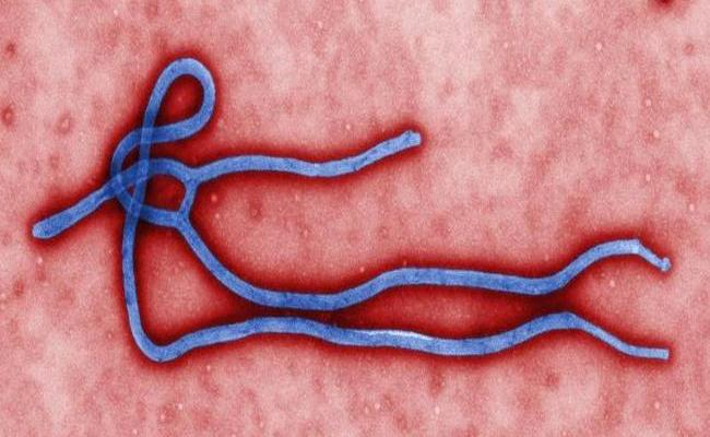 Ebola-Virus (Quelle: Cynthia Goldsmith / CDC)