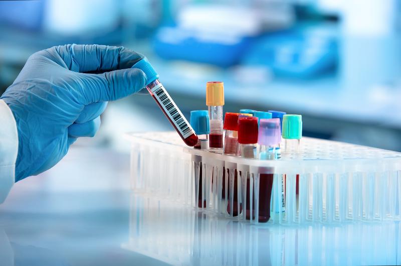 Blood samples (Source: angellodeco / Shutterstock)