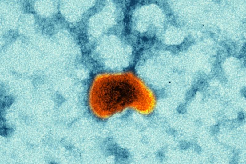 Measles vaccine virus (Source: K. Boller / Paul-Ehrlich-Institut)