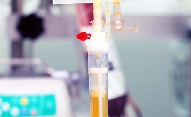 Plasma infusion (Source: sfam photo / Shutterstock)