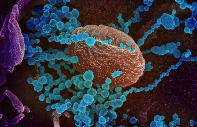 Elektromikroskope picture of SARS-CoV-2 (Source: www.niaid.nih.gov) Elektromikroskope picture of SARS-CoV-2 (Source: www.niaid.nih.gov)